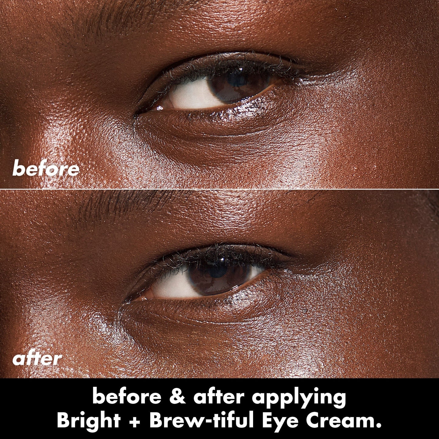 bright-brew-tiful-eye-cream-u8 0226_BBEC_Eye_BA_Diptych_607e3ec2-f0e1-4365-9b28-17574d841250.jpg