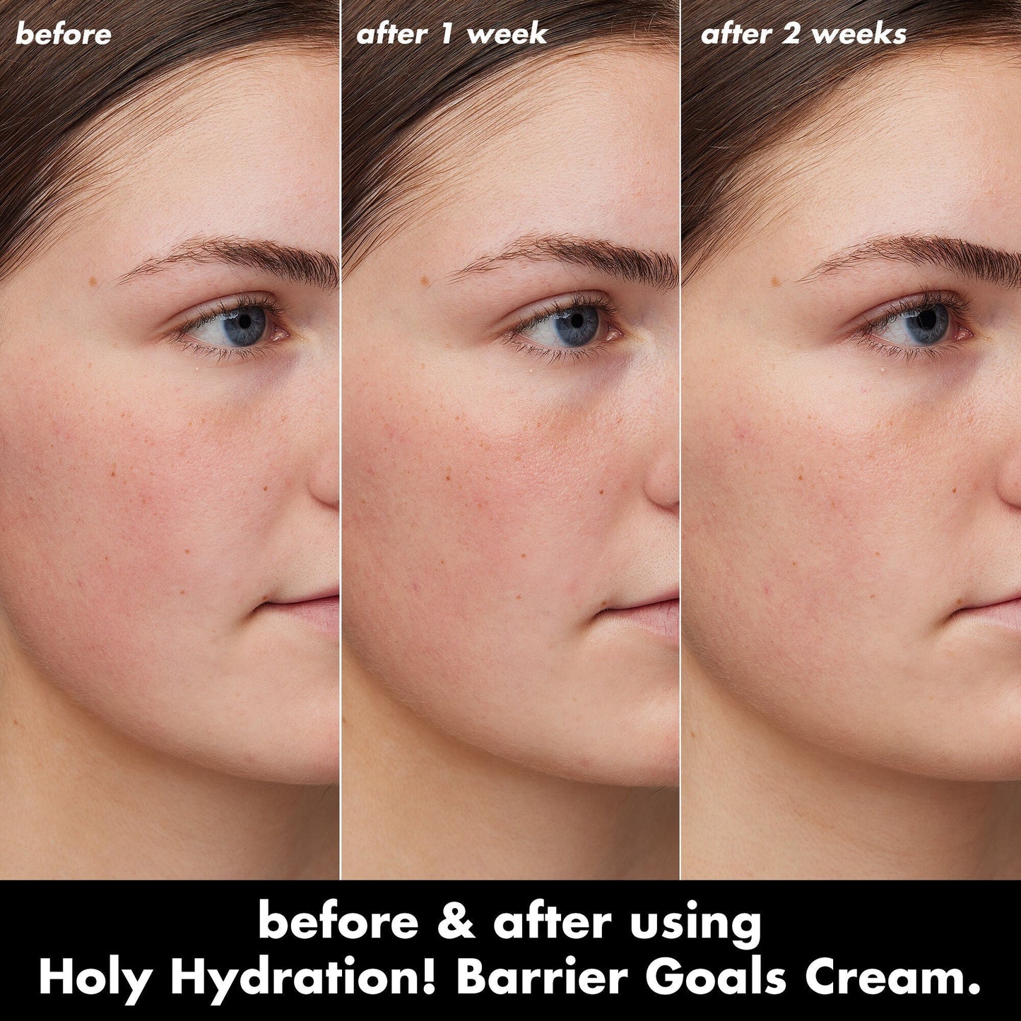holy-hydration-barrier-goals-cream-mini-p9 0226_EDU_HHBarrierGoalsCream_B_A_Zoe_TRYPTICH_4f0e5b5d-35fb-4020-968e-244d4536afbd.jpg