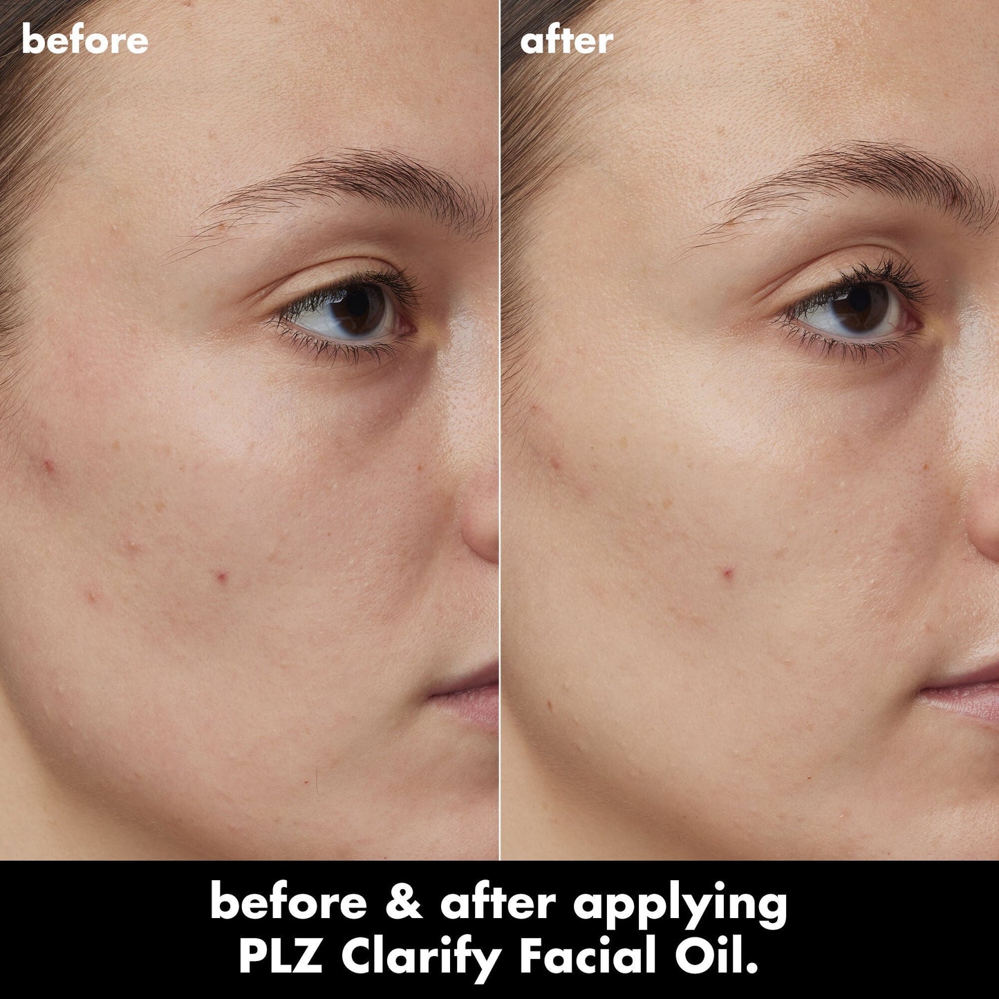 plz-clarify-facial-oil-o5 0326_EDU_PlzClarify_BA_Kelly.jpg