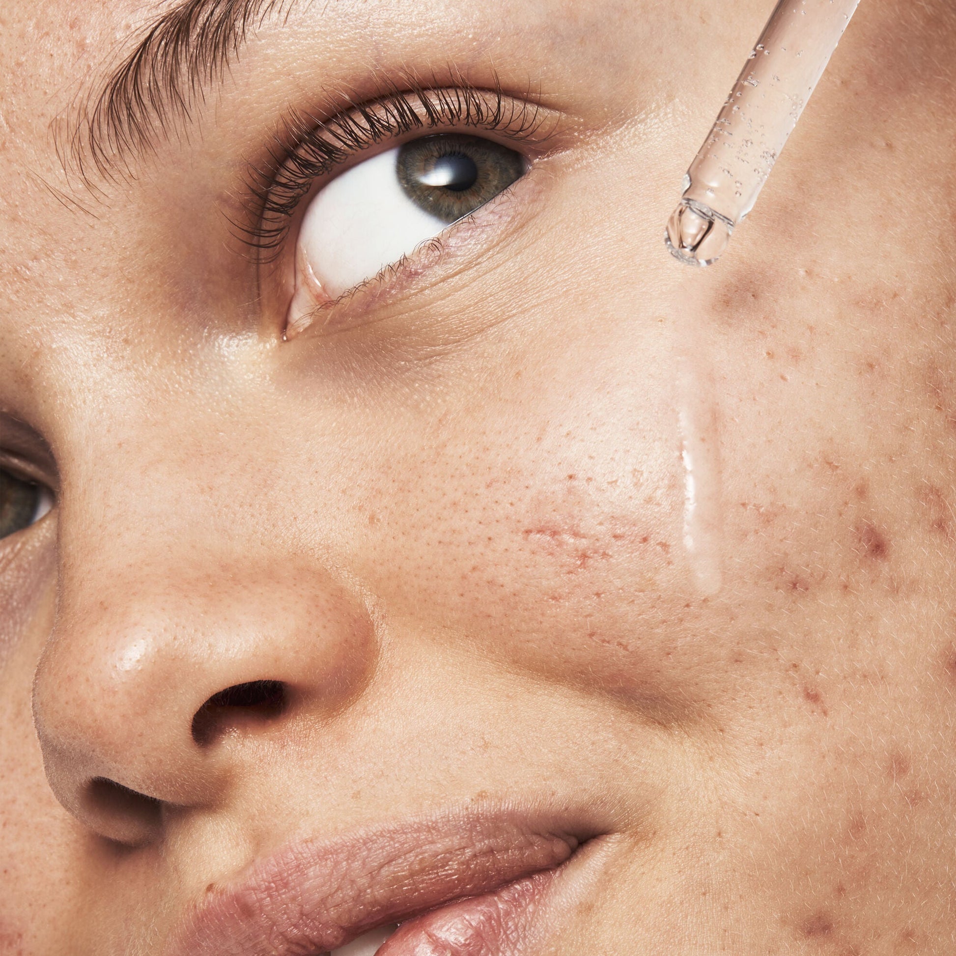 blemish-breakthrough-triple-acid-resurfacing-serum-g4 121321_Marley-Acne-Regimen_0254_FINAL_IGF.jpg