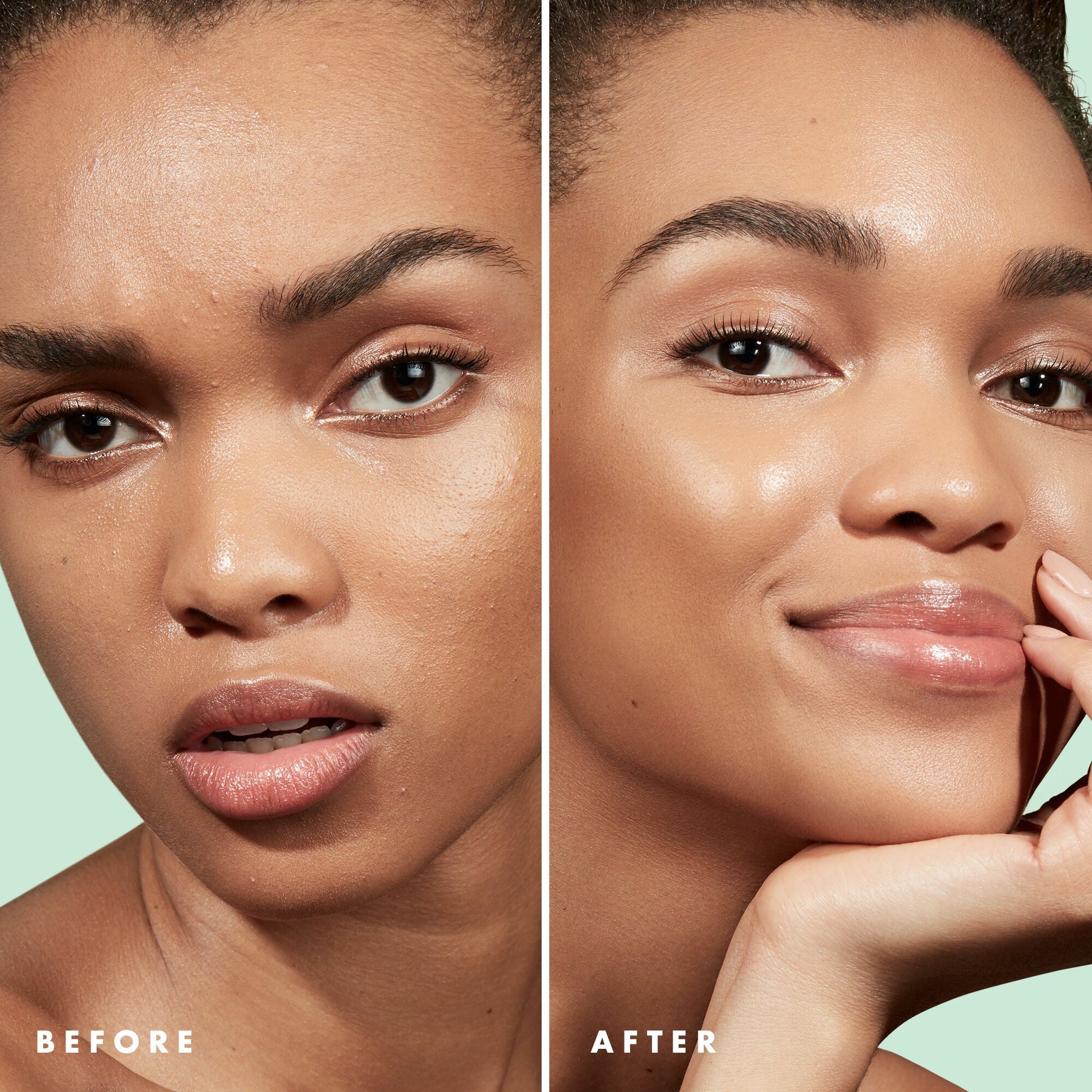 blemish-control-face-primer-large-size-e0 Primer_PP_Before_After_BlemishControl_2000x2000_3774231e-d4e1-49dd-b3d7-a73cbac901fe.jpg